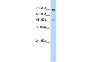 WB Suggested Anti-ZNF821 Antibody Titration:  0. (ZNF821 anticorps  (C-Term))