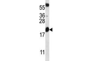 BCL2 antibody western blot analysis in mouse heart tissue lysate