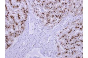 IHC-P Image TPP1 antibody detects TPP1 protein at cytosol on human normal liver by immunohistochemical analysis.