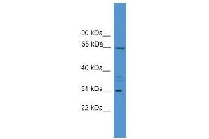 MEPE antibody used at 0. (MEPE anticorps  (Middle Region))