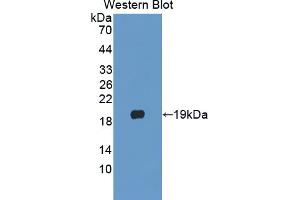 Western blot analysis of the recombinant protein. (PLA2G10 anticorps  (AA 32-165))