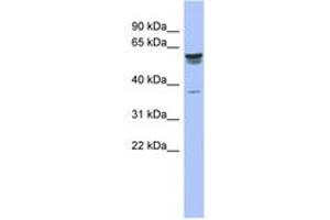 Image no. 1 for anti-Tripartite Motif-containing 4 (TRIM4) (AA 107-156) antibody (ABIN6742533) (TRIM4 anticorps  (AA 107-156))