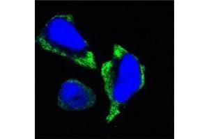 Confocal immunofluorescence analysis of Hela cells using PAK2 antibody (green). (PAK2 anticorps)