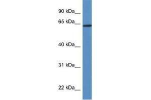 Human Jurkat; WB Suggested Anti-HOXD3 Antibody Titration: 0. (HOXD3 anticorps  (Middle Region))