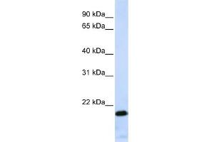WB Suggested Anti-ZNF428 Antibody Titration:  0. (ZNF428 anticorps  (Middle Region))