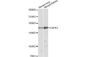 Western blot analysis of extracts of various cell lines, using DAPK1 Antibody (ABIN5973367) at 1/1000 dilution. (DAP Kinase 1 anticorps)