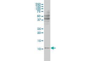 BANF1 monoclonal antibody (M01), clone 3F10-4G12 Western Blot analysis of BANF1 expression in Jurkat .