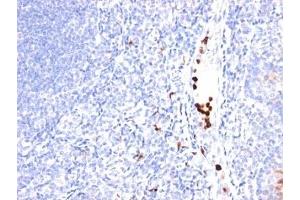 Formalin-fixed, paraffin-embedded human tonsil stained with MYDAM antibody (MYADM/971).