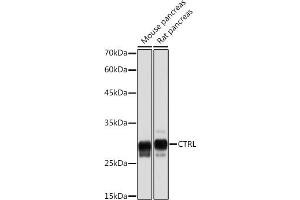 Western blot analysis of extracts of various cell lines, using CTRL Rabbit mAb (ABIN7266395) at 1:5000 dilution. (Chymotrypsin anticorps)