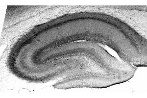 Adult rat hippocampus immunohistochemistry.