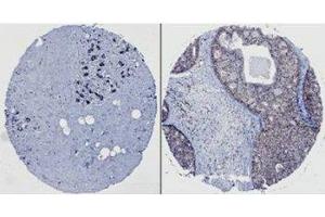 Image no. 3 for anti-Neural Precursor Cell Expressed, Developmentally Down-Regulated 9 (NEDD9) (AA 82-398) antibody (ABIN7278755) (NEDD9 anticorps  (AA 82-398))