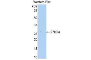 Western Blotting (WB) image for anti-alpha-2-Macroglobulin (A2M) (AA 216-437) antibody (ABIN1077782) (alpha 2 Macroglobulin anticorps  (AA 216-437))