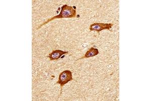 (ABIN6242174 and ABIN6578338) staining ATP2A3 in human brain tissue sections by Immunohistochemistry (IHC-P - paraformaldehyde-fixed, paraffin-embedded sections).
