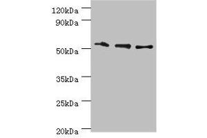 Western blot All lanes: RMDN3 antibody at 4 μg/mL Lane 1: Hela whole cell lysate Lane 2: MCF-7 whole cell lysate Lane 3: Mouse liver tissue Secondary Goat polyclonal to rabbit IgG at 1/10000 dilution Predicted band size: 53, 39 kDa Observed band size: 53 kDa (RMDN3 anticorps  (AA 171-470))