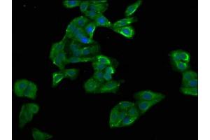 Immunofluorescence staining of HepG2 cells with ABIN7154468 at 1:100, counter-stained with DAPI. (GADD45B anticorps  (AA 1-160))
