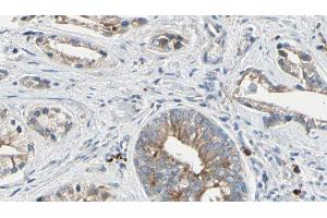 ABIN6278142 at 1/100 staining Human prostate tissue by IHC-P. (PTP4A2 anticorps  (Internal Region))