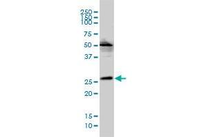 MGC10540 monoclonal antibody (M01), clone 2E5-2B9 Western Blot analysis of MGC10540 expression in Hela S3 NE .