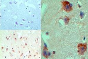 Image no. 1 for anti-Histone Deacetylase 9 (HDAC9) (AA 100-150) antibody (ABIN960197)