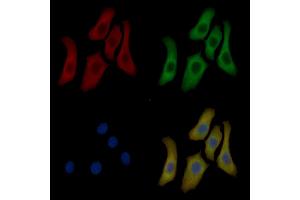 Annexin A2 Mouse Monoclonal Antibody staining Hela cells by IF/ICC.