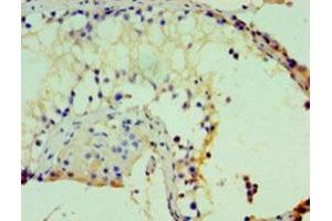 IHC analysis of paraffin-embedded human kidney tissue, using ASH2L antibody (1/100 dilution). (ASH2L anticorps  (AA 1-534))