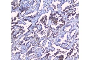 IHC analysis of SRI using anti-SRI antibody (ABIN6719388).