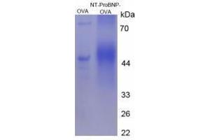 Image no. 3 for Pro-Brain Natriuretic Peptide (NT-ProBNP) (NT-ProBNP) (N-Term) peptide (Ovalbumin) (ABIN5666287) (Pro-Brain Natriuretic Peptide (NT-ProBNP) (NT-ProBNP) (N-Term) peptide (Ovalbumin))