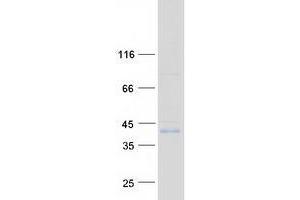 Validation with Western Blot