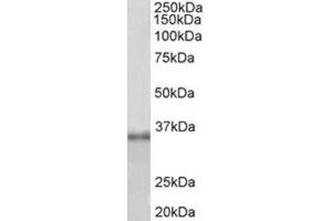 Western Blotting (WB) image for anti-Fibrillarin (FBL) (Internal Region) antibody (ABIN1107198) (Fibrillarin anticorps  (Internal Region))