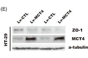 MCT4 destroys epithelial barrier function and inhibits ZO-1 expression. (TJP1 anticorps  (AA 1600-1700))