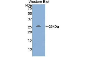 Western Blotting (WB) image for anti-CD79b Molecule, Immunoglobulin-Associated beta (CD79B) (AA 37-226) antibody (ABIN1859292) (CD79b anticorps  (AA 37-226))