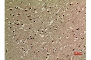 Immunohistochemistry (IHC) analysis of paraffin-embedded Human Brain, antibody was diluted at 1:100.