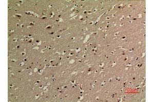 Immunohistochemistry (IHC) analysis of paraffin-embedded Human Brain, antibody was diluted at 1:100. (NF-kB p65 anticorps  (acLys314, acLys315))