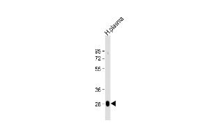 Anti-CFD Antibody (N-term) at 1:2000 dilution + human plasma lysate Lysates/proteins at 20 μg per lane. (Adipsin anticorps  (N-Term))