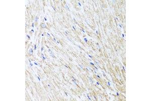 Immunohistochemistry of paraffin-embedded mouse heart using L2HGDH antibody at dilution of 1:100 (x40 lens). (L2HGDH anticorps)
