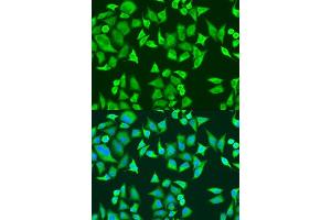 Immunofluorescence analysis of U2OS cells using SMN2 antibody (ABIN6127948, ABIN6148135, ABIN6148138 and ABIN6216175) at dilution of 1:100. (SMN2 anticorps  (AA 1-197))