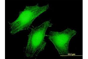 Immunofluorescence of purified MaxPab antibody to LARP6 on HeLa cell.