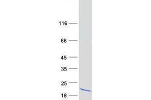 Validation with Western Blot