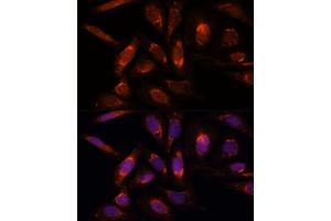 Immunofluorescence analysis of U-2 OS cells using POLRMT antibody (ABIN7269460) at dilution of 1:100.