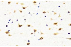 Immunohistochemistry of paraffin-embedded Rat brain using TIA1 Polyclonal Antibody at dilution of 1:100 (40x lens). (TIA1 anticorps)