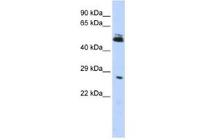 RNF212 antibody used at 1 ug/ml to detect target protein.