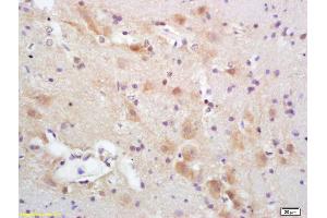 Formalin-fixed and paraffin embedded rat brain labeled with Rabbit Anti CYP5A1/Thromboxane synthase Polyclonal Antibody, Unconjugated (ABIN726065) at 1:200 followed by conjugation to the secondary antibody and DAB staining (PACAP-27/38 (AA 132-169) anticorps)