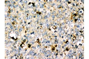 Anti-MyD88 antibody, IHC(P) IHC(P): Human Tonsil Tissue