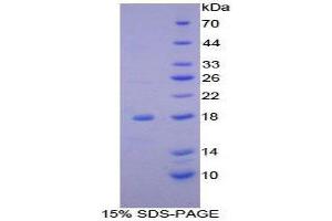 SDS-PAGE (SDS) image for NADH Dehydrogenase (Ubiquinone) 1, alpha/beta Subcomplex, 1, 8kDa (NDUFAB1) (AA 3-129) protein (His tag) (ABIN2123912) (NDUFAB1 Protein (AA 3-129) (His tag))