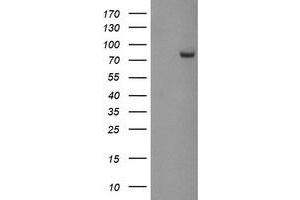 HEK293T cells were transfected with the pCMV6-ENTRY control (Left lane) or pCMV6-ENTRY PADI4 (Right lane) cDNA for 48 hrs and lysed.