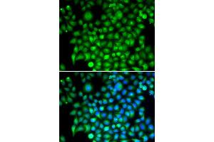Immunofluorescence (IF) image for anti-Complement Factor I (CFI) antibody (ABIN1876824) (Complement Factor I anticorps)