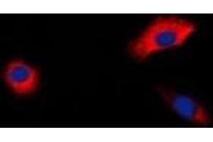 Immunofluorescent analysis of Beta-1 Adrenergic Receptor staining in HepG2 cells. (ADRB1 anticorps)