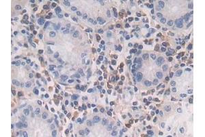 Detection of TGFb2 in Human Stomach Tissue using Polyclonal Antibody to Transforming Growth Factor Beta 2 (TGFb2)