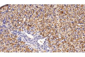 Detection of AST2 in Rat Ovary Tissue using Polyclonal Antibody to Aspartate Aminotransferase 2 (AST2) (AST2 (AA 30-430) anticorps)