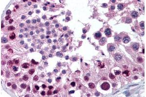 Human Testis (formalin-fixed, paraffin-embedded) stained with MTA2 antibody ABIN301765 at 10 ug/ml followed by biotinylated goat anti-rabbit IgG secondary antibody ABIN481713, alkaline phosphatase-streptavidin and chromogen. (MTA2 anticorps  (AA 650-700))