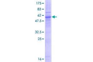 Image no. 1 for Emerin (EMD) (AA 1-254) protein (GST tag) (ABIN1352742)